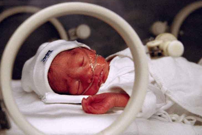 bambino neonato prematuro in incubatrice