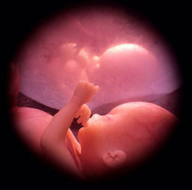 un bambino nel grembo da 30 settimane - no aborto