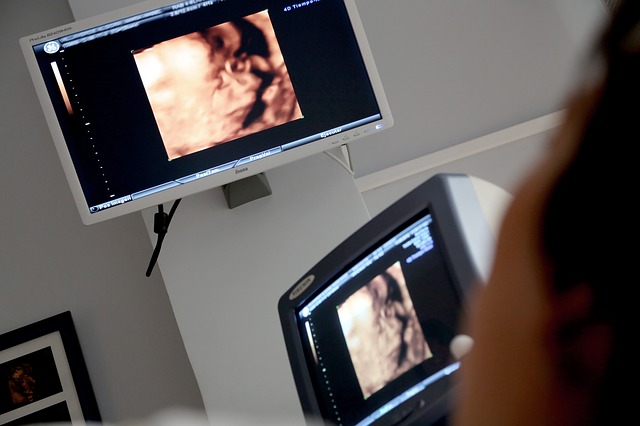 Il ginecologo Dellino: «Vi racconto il dolore visto nelle donne che abortiscono» 1