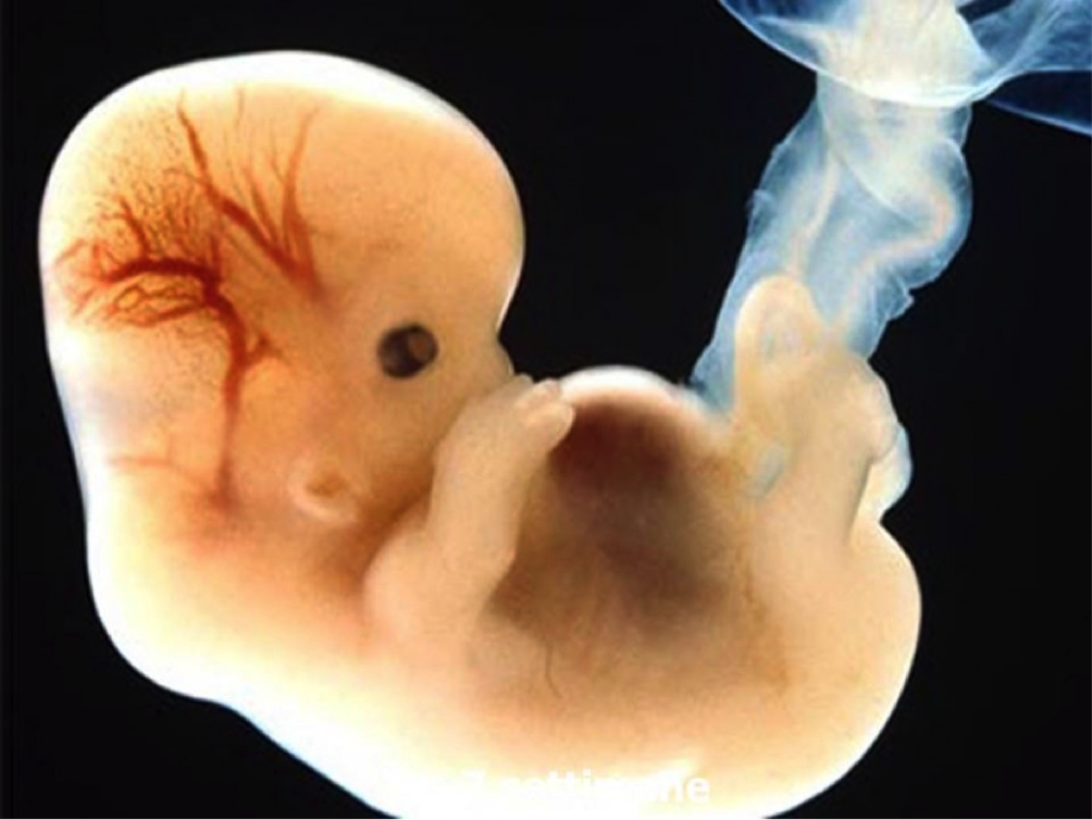 Aborto: quello che non ti hanno mai mostrato 1