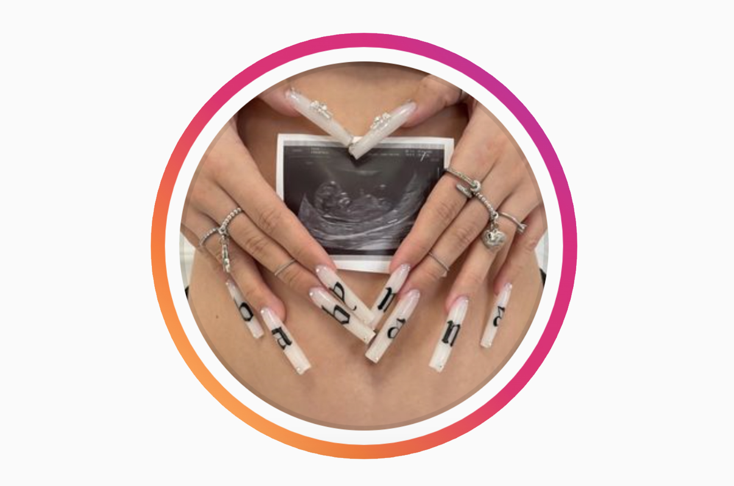 Il bellissimo esempio dell'influencer italiana: «Dopo la prima ecografia ho capito che l’aborto non era per me» 1