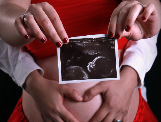 Proposta di legge “Un Cuore che batte”. Fino al 7 novembre una firma può salvare la vita dei nascituri 1
