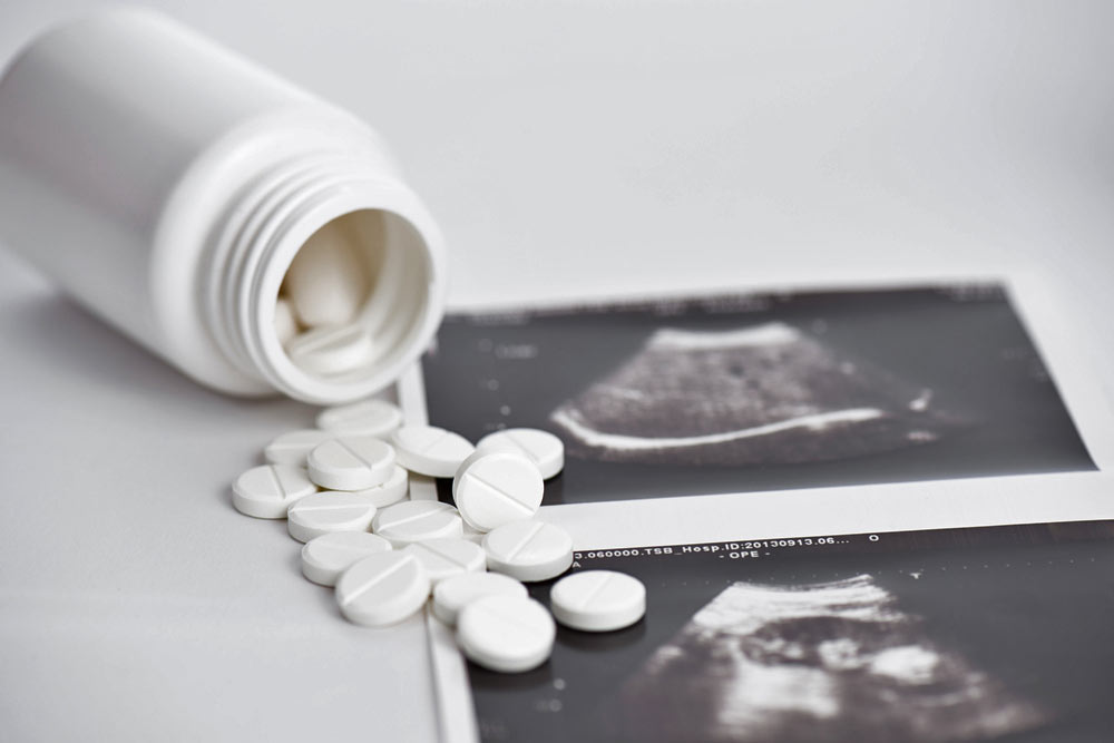 Aborto. L'Emilia-Romagna si rifiuta di garantire la sicurezza alle donne, cosa è successo 1
