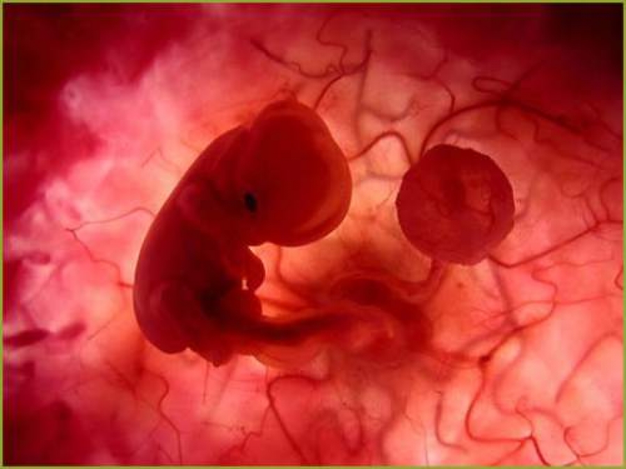 Aborto: la strage silenziosa 1