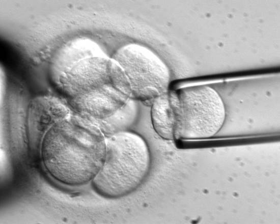 Eugenetica di Stato: sì alla diagnosi preimpianto 1