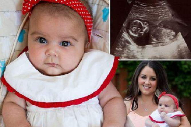 Sopravvissuta ad un aborto spontaneo e ad un trattamento con pillola abortiva – Ecco la bambina del miracolo 1