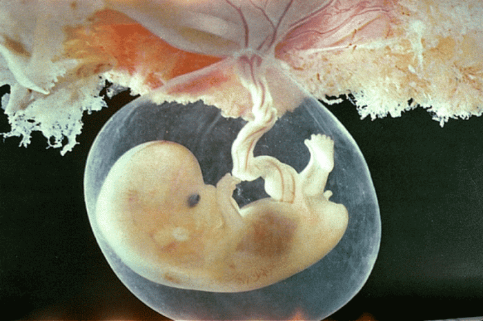 feto_persona_embrione