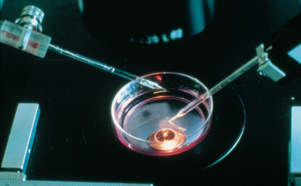 L’inseminazione artificiale genera mostri? 1