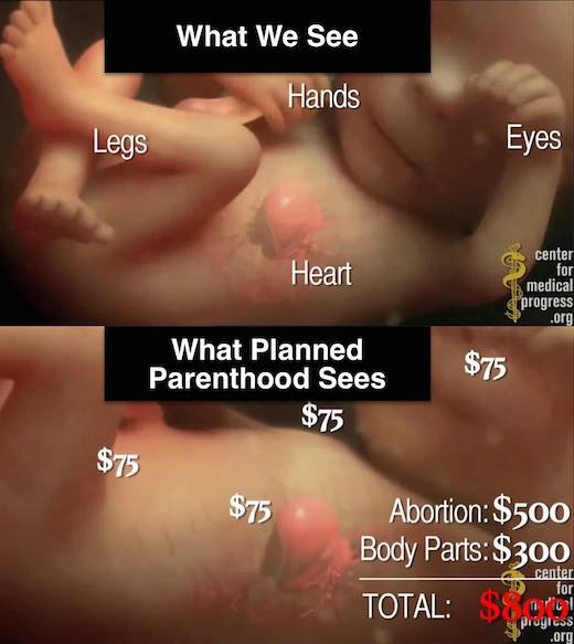 planned parenthood_aborto_traffico_organi