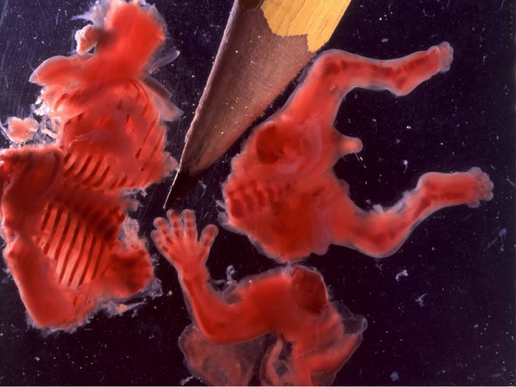 Организм после прерывания. Абортируемые плоды эмбрионы. Человеческий зародыш выкидыш. Абортированный зародыш 12 недель.